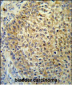 TM222 Antibody (Center)